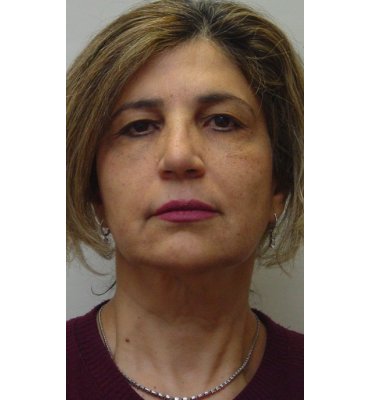 brusie after surgery